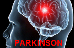 Asociacion de Parkinson Alhaurin de la Torre